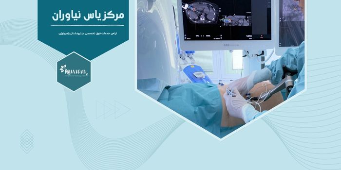 مایکروویو توده های کبدی چگونه است و بهترین مرکز آن در تهران؟