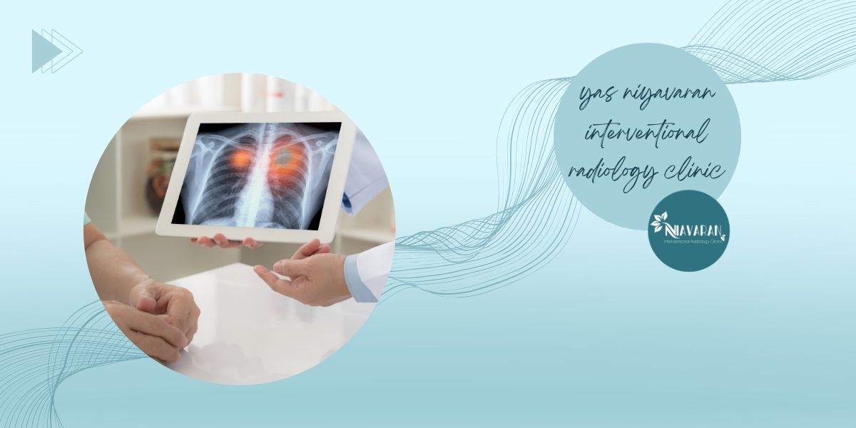 تاثیر مایکروویو در جلوگیری از رشد تومور تاثیر مایکروویو در جلوگیری از رشد تومور
