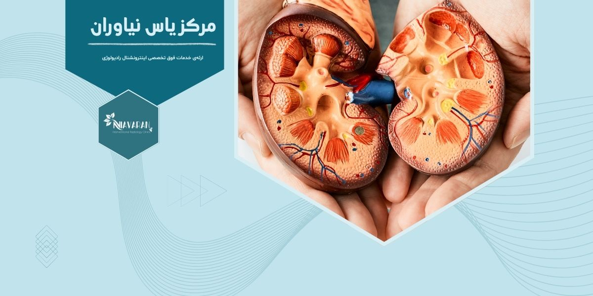 نحوه عملکرد مایکروویو کلیه نحوه عملکرد مایکروویو کلیه