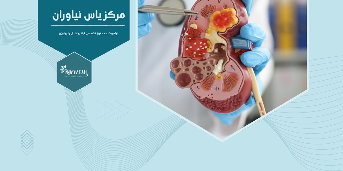خطرات و عوارض مایکروویو کلیه خطرات و عوارض مایکروویو کلیه