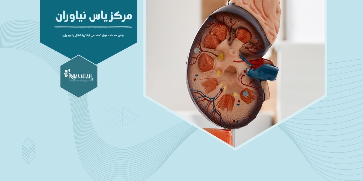 درمان با مایکروویو کلیه برای چه کسانی مناسب نیست؟ درمان با مایکروویو کلیه برای چه کسانی مناسب نیست؟