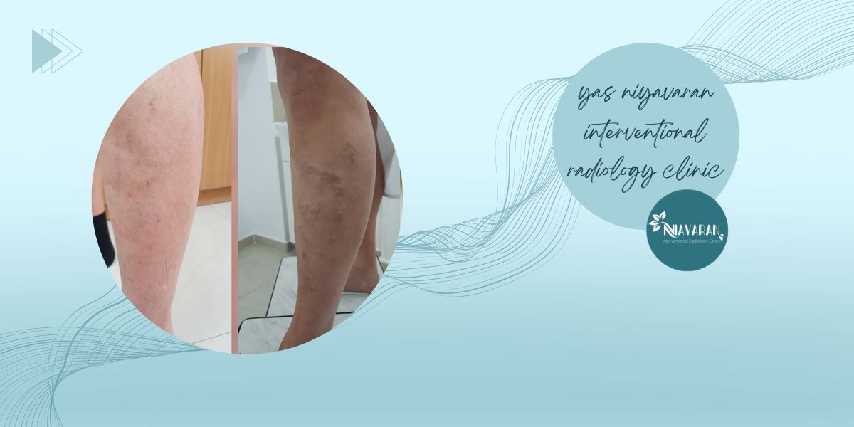 تأثیرگذاری تأثیرگذاری