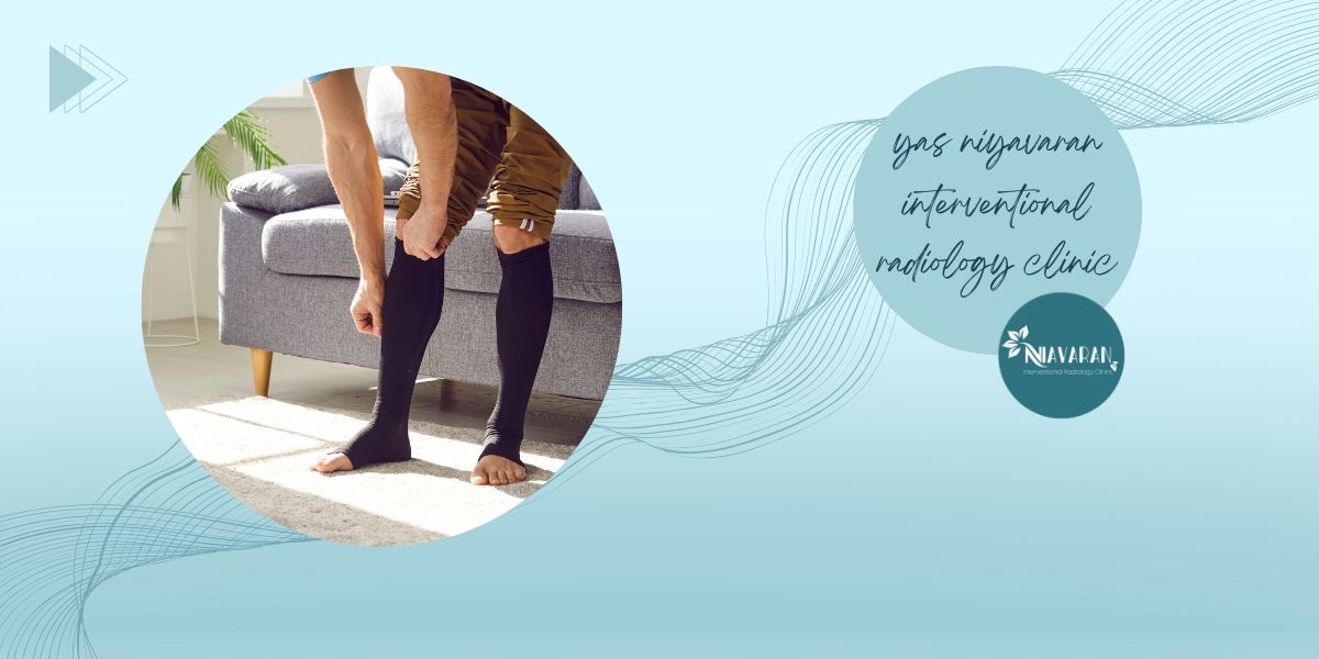 پیشگیری از واریس پیشگیری از واریس