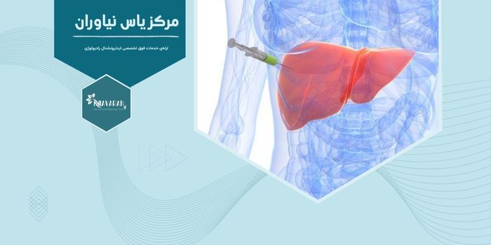 بهترین مرکز نمونه برداری کبد در تهران | بیوپسی با هدایت سونوگرافی بهترین مرکز نمونه برداری کبد در تهران | بیوپسی با هدایت سونوگرافی