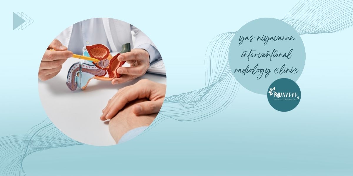 دلایل بیوپسی پروستات 