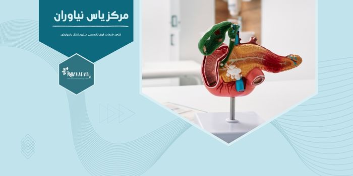 تشخیص و درمان غیرجراحی توده‌های مجاری صفراوی
