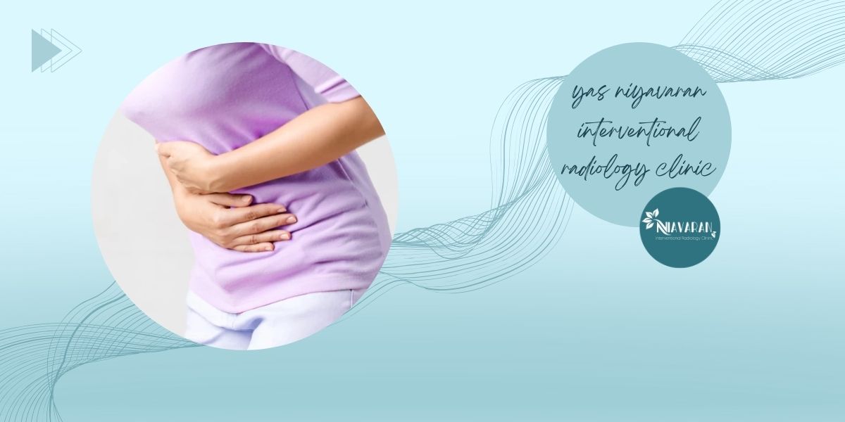 علائم آندومتریوز و آندومتریوما