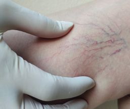 قلب و عروق قلب و عروق