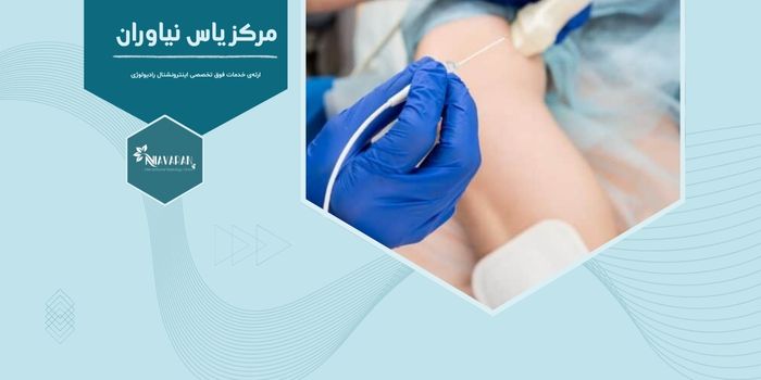 آیا RF واریس درد دارد یا نه و چند جلسه لازم است؟ آیا RF واریس درد دارد یا نه و چند جلسه لازم است؟