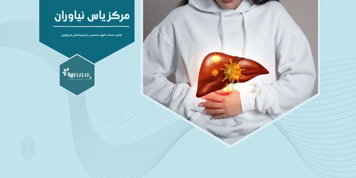 آیا بیماران مبتلا به سیروز کبدی باید نمونه‌برداری کبد انجام دهند؟