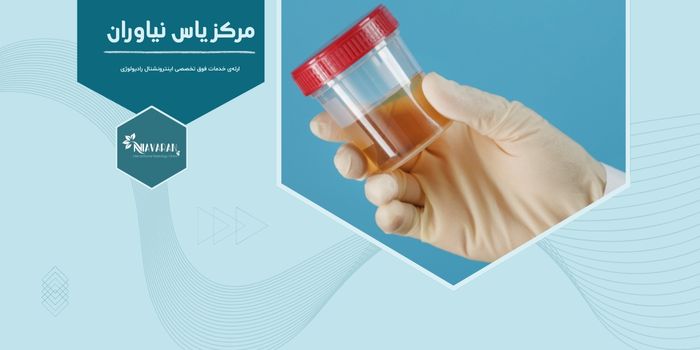 آیا خون در ادرار همیشه نشانه بیماری پروستات است؟ 