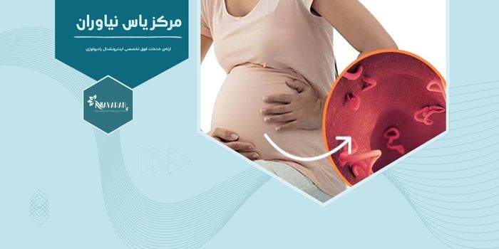آیا در دوران بارداری می‌توان فیبروم رحمی را درمان کرد؟