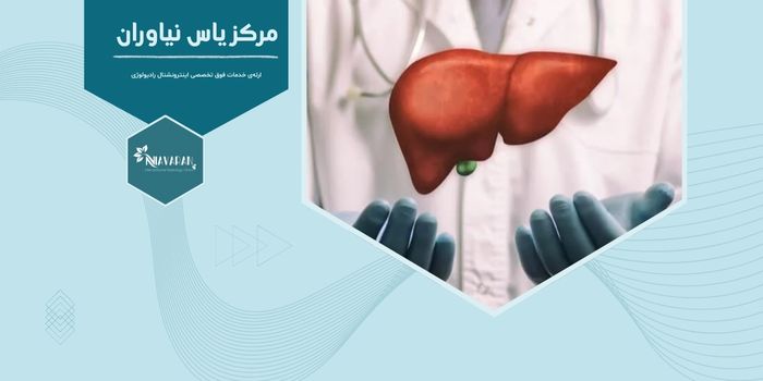 آیا درمان‌های غیرجراحی می‌توانند جایگزین پیوند کبد شوند؟