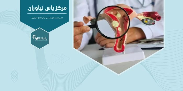 آیا فیبروم رحم خود به‌ خود از بین می‌رود؟