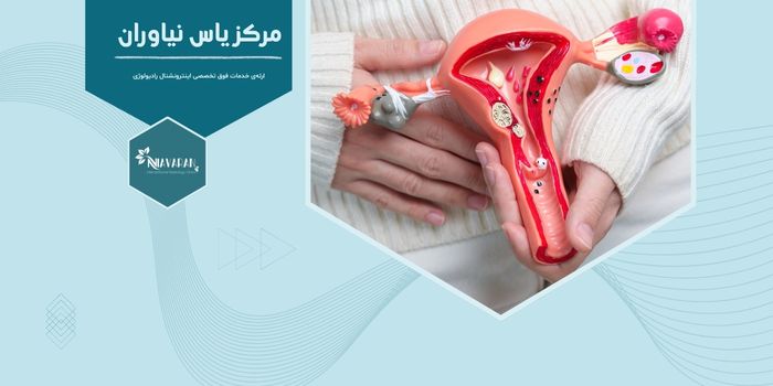 آیا فیبروم رحمی به سرطان تبدیل می‌شود و خطرناک است؟