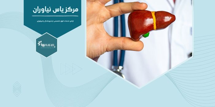 آیا نمونه‌برداری از کبد برای تشخیص بیماری‌های کبد چرب ضروری است؟