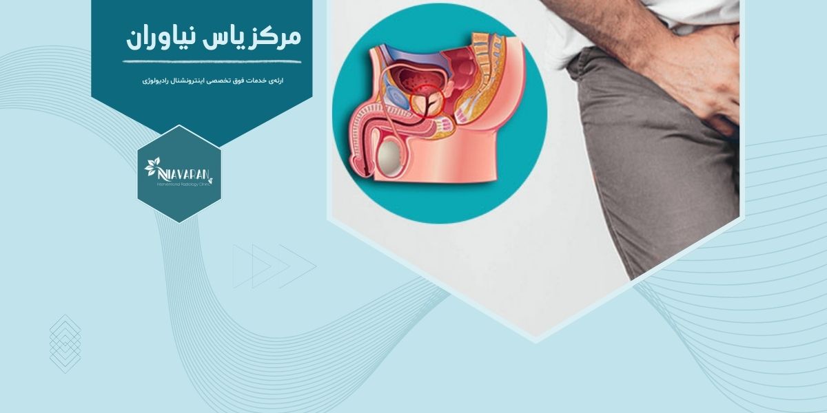 آیا نمونه‌برداری پروستات درد دارد؟ مقدار درد آن چقدر است؟ 
