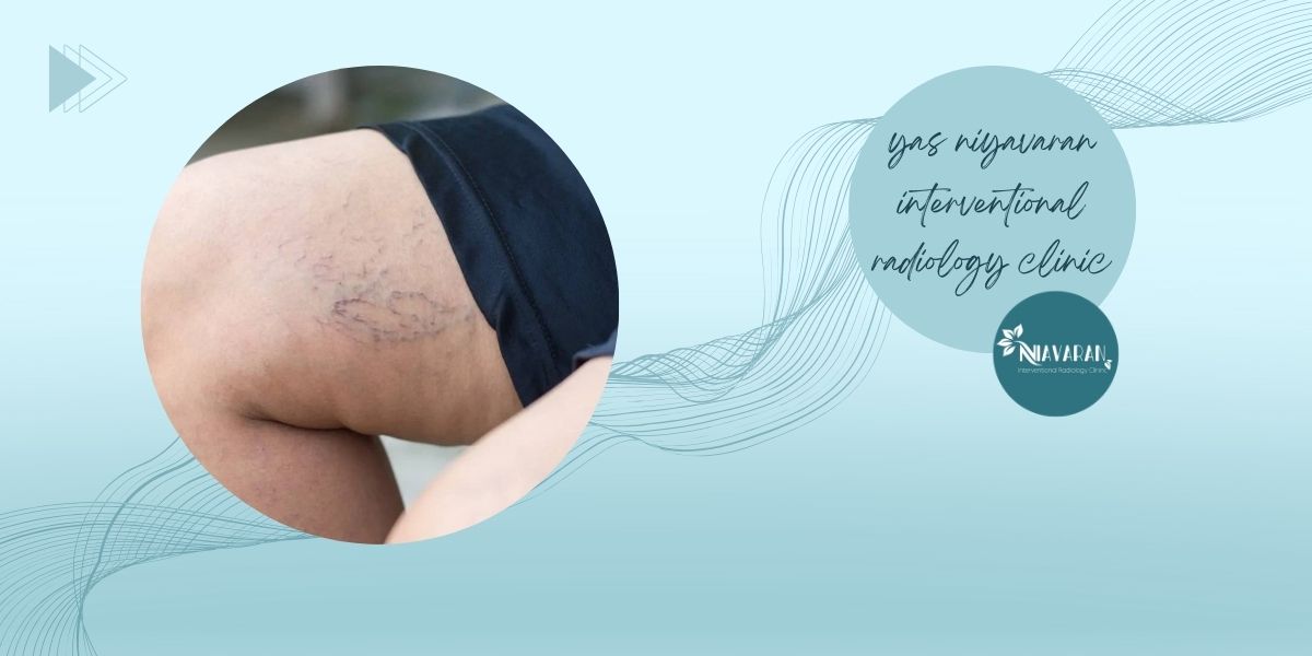 انواع مویرگ‌