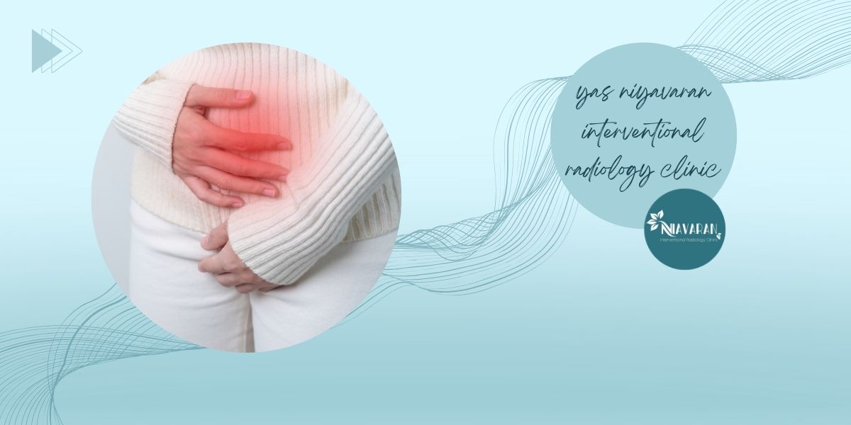 اهمیت خونریزی شدید قاعدگی اهمیت خونریزی شدید قاعدگی