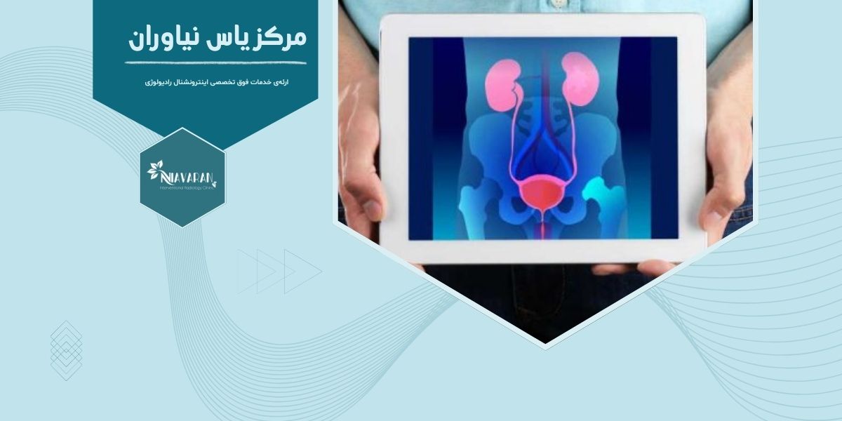 بزرگ شدن پروستات در جوانی چه دلایلی دارد؟ بررسی علل شایع
