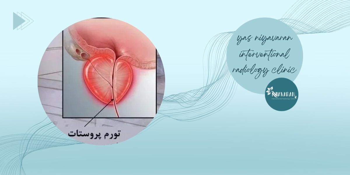 آیا بزرگ شدن پروستات در جوانی طبیعی است؟