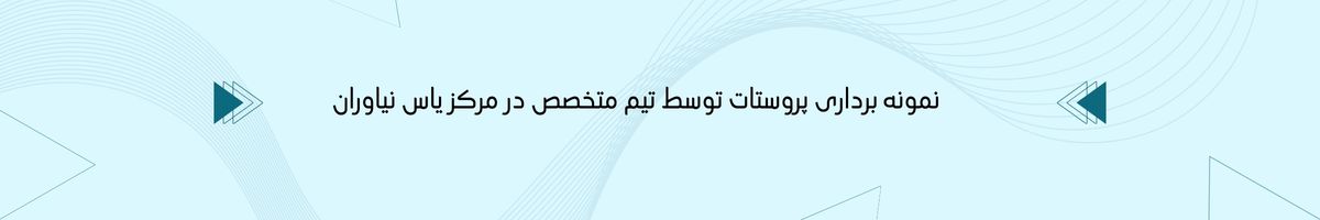 جایگزین‌های بیوپسی پروستات  