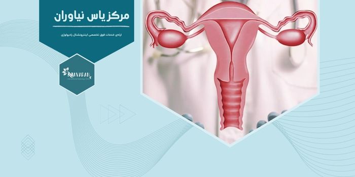 جدیدترین و بهترین روش‌های درمان فیبروم رحم