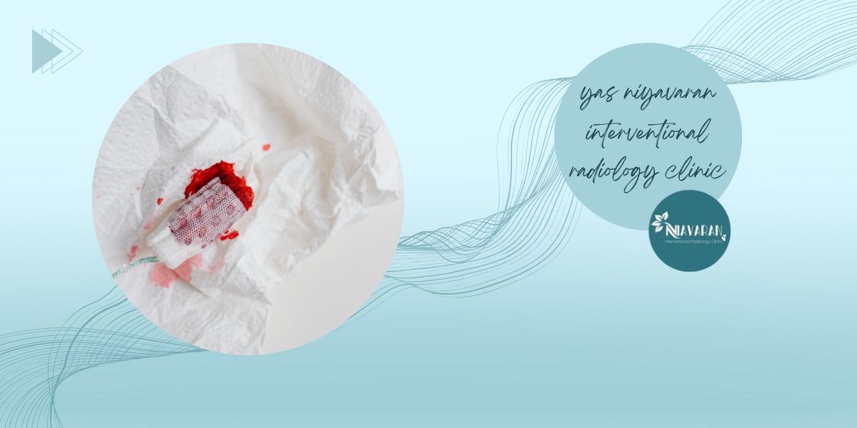 دلایل شایع دلایل شایع