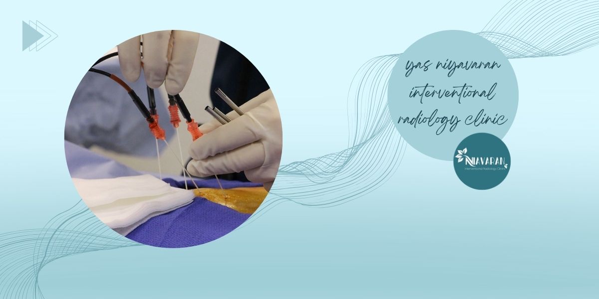 روش های درمان روش های درمان