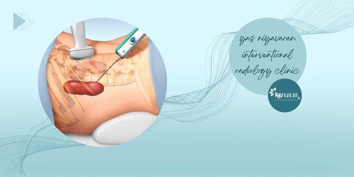 روش‌های تشخیص 