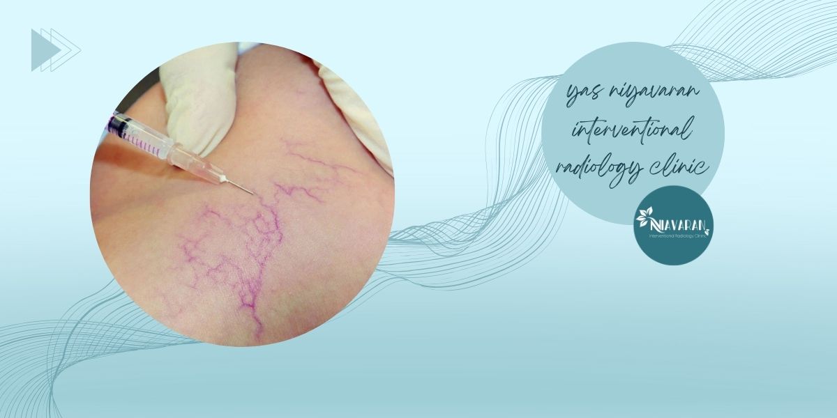 راهکارهای درمان 