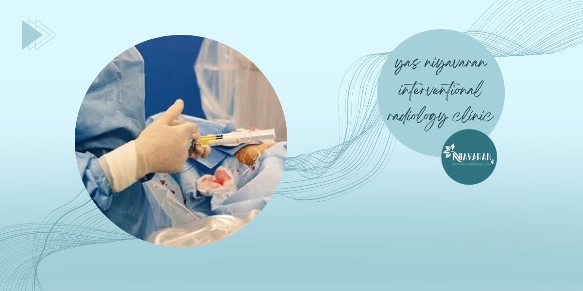 روش‌های درمان غیرتهاجمی میوم رحم