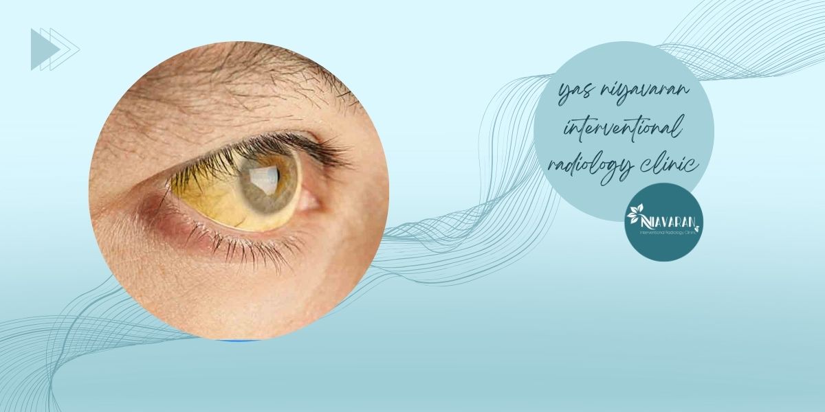 علائم تومورها علائم تومورها