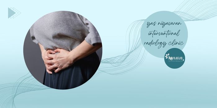 عوارض شایع آمبولیزاسیون شریان رحمی عوارض شایع آمبولیزاسیون شریان رحمی