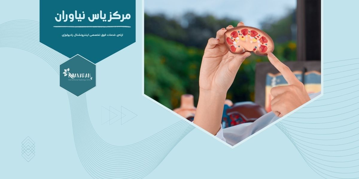 مایکروویو کلیه چه نوع درمانی است و در تهران کجا انجام می شود؟ مایکروویو کلیه چه نوع درمانی است و در تهران کجا انجام می شود؟