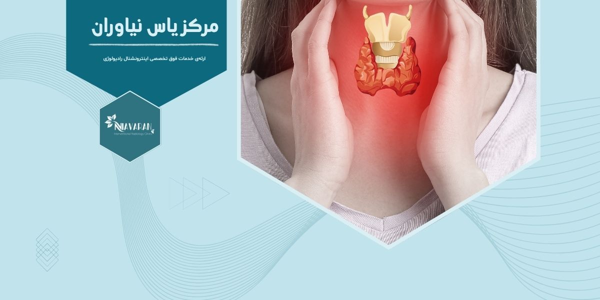ماکروویو ندول های تیروئید چیست و در تهران کجا انجام می شود؟ ماکروویو ندول های تیروئید چیست و در تهران کجا انجام می شود؟