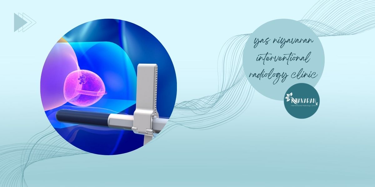 موارد منع نمونه‌برداری 