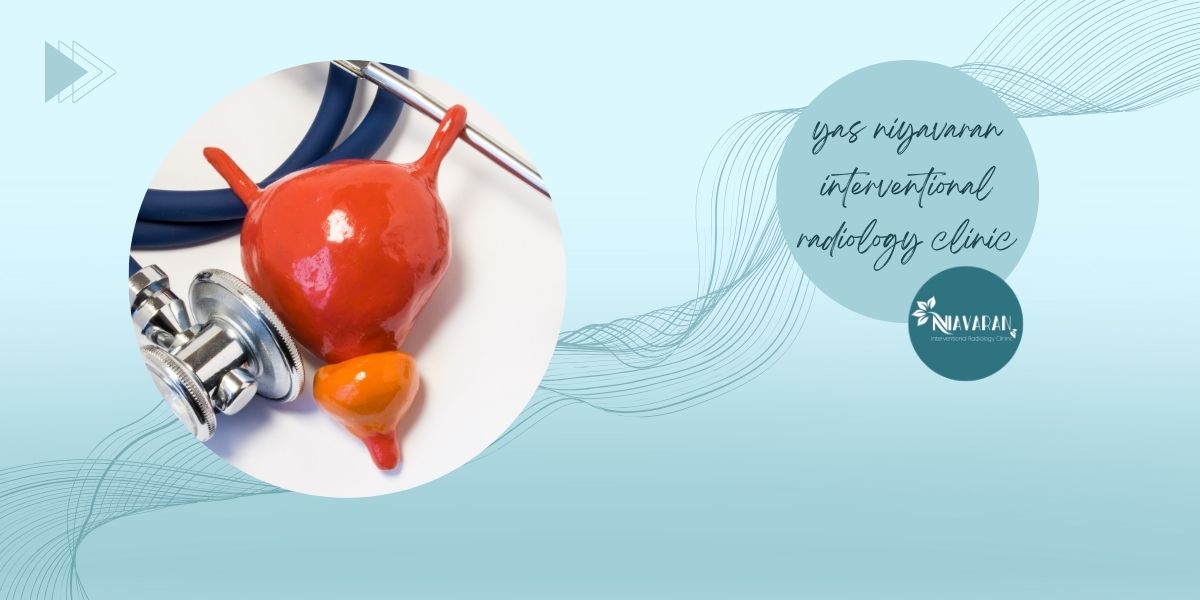 موارد منع نمونه‌برداری 