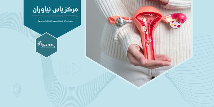 چرا خونریزی شدید قاعدگی مهم است و نشانه چیست؟ چرا خونریزی شدید قاعدگی مهم است و نشانه چیست؟