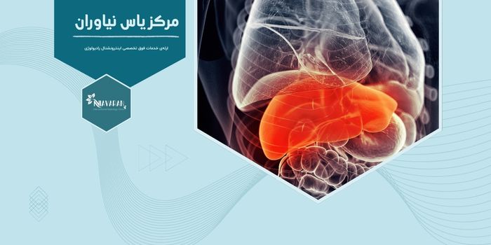 چطور می‌توان توده‌های کبدی را بدون عمل جراحی درمان کرد؟