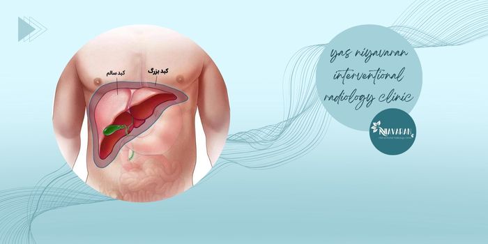 در چه بیماری‌هایی بیوپسی کبد توصیه می‌شود؟