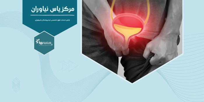 آیا درد پایین شکم در مردان میتواند نشانه التهاب پروستات باشد؟ آیا درد پایین شکم در مردان میتواند نشانه التهاب پروستات باشد؟